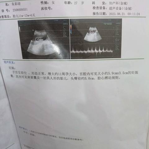 11周4天是几个月